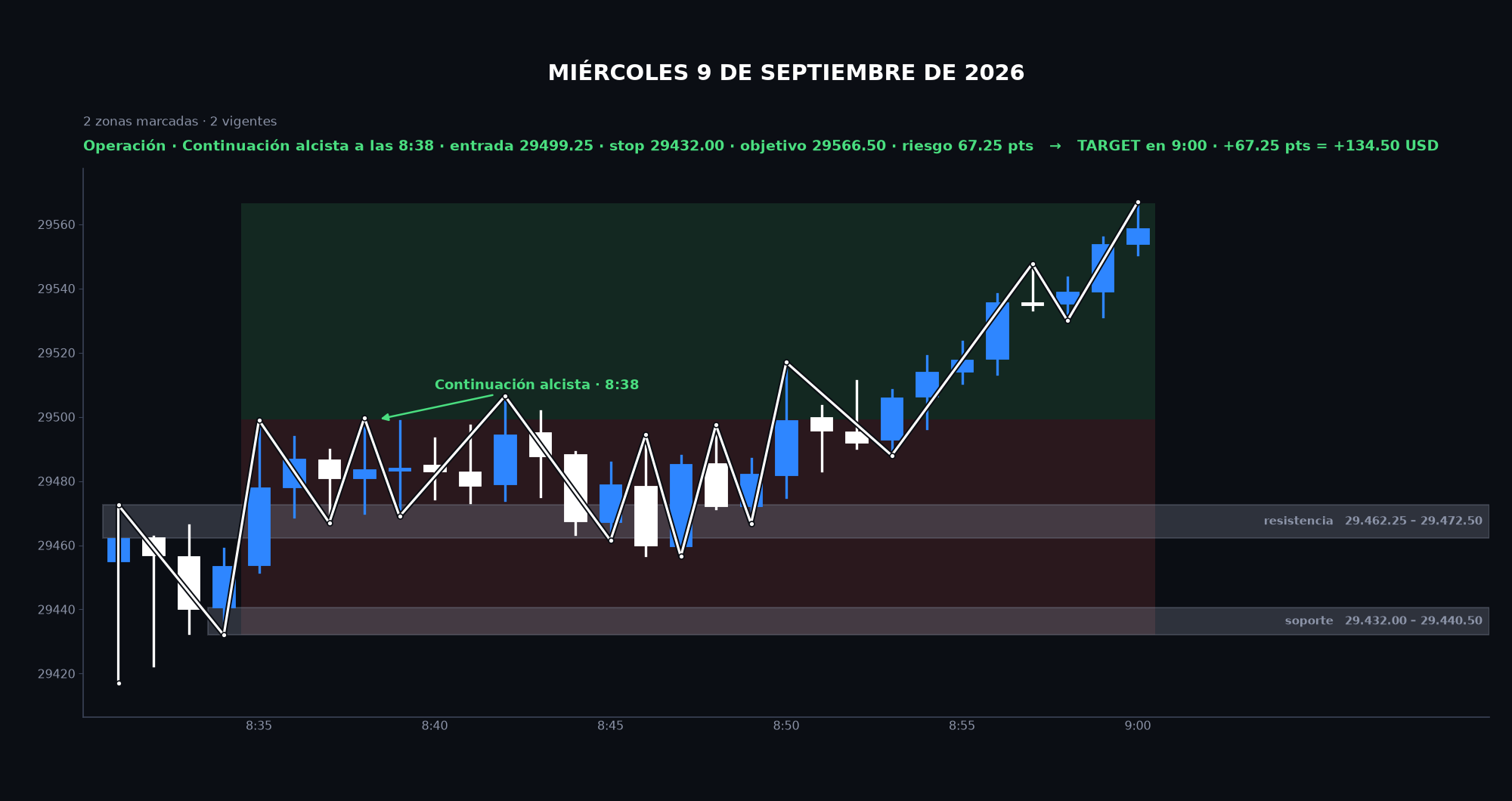 Gráfico de la sesión: Miércoles 9 de septiembre de 2026